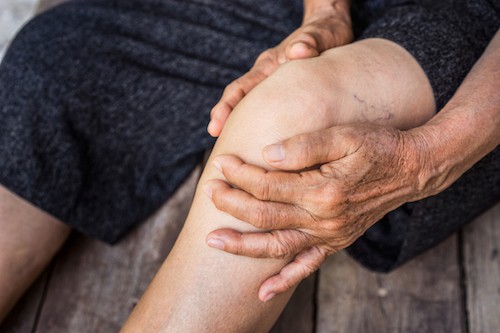 man with vascular leg problem holds knee with joint pain