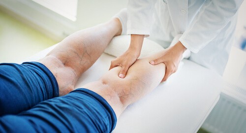 board certified doctor checks patient for venous insufficiency